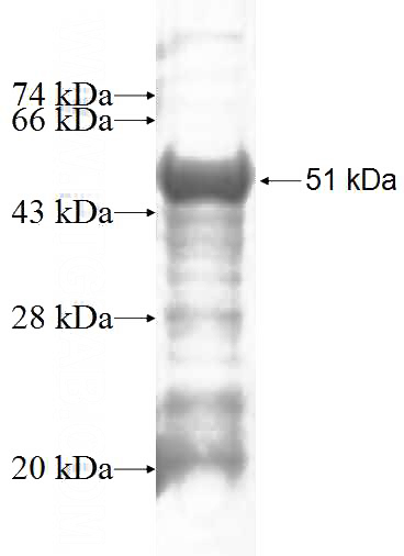 Recombinant Human KPNA5 SDS-PAGE
