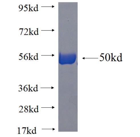 Recombinant human RAB3A SDS-PAGE