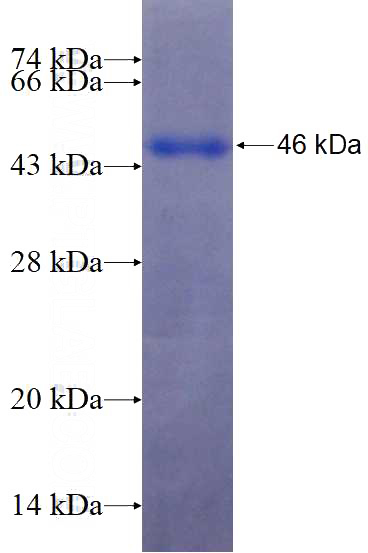 Recombinant Human DNA2 SDS-PAGE