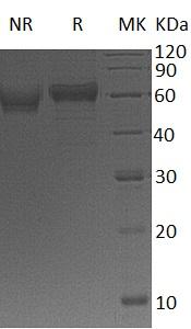Human GFRA1/GDNFRA/RETL1/TRNR1 (His tag) recombinant protein