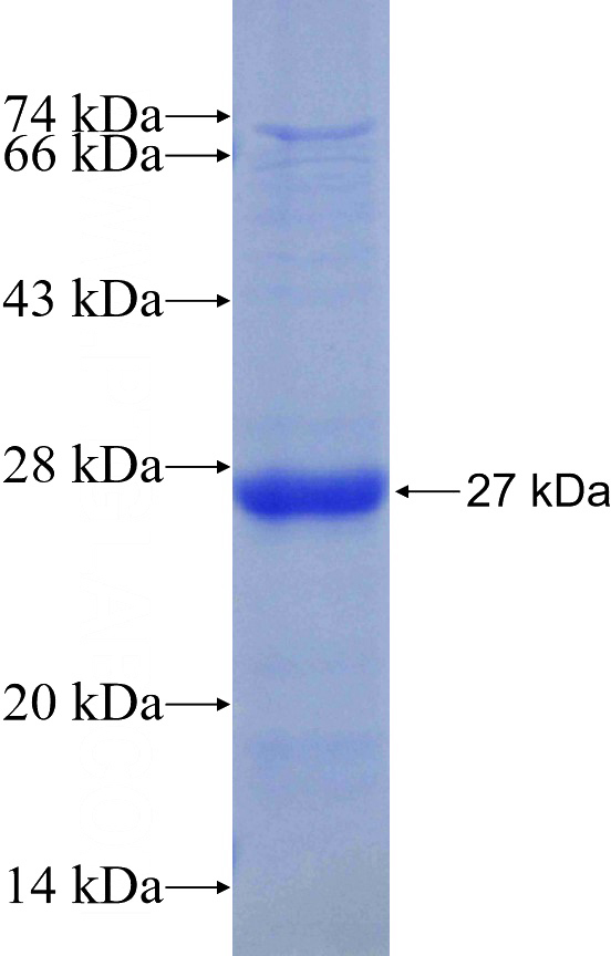 Recombinant Human MIB2 SDS-PAGE