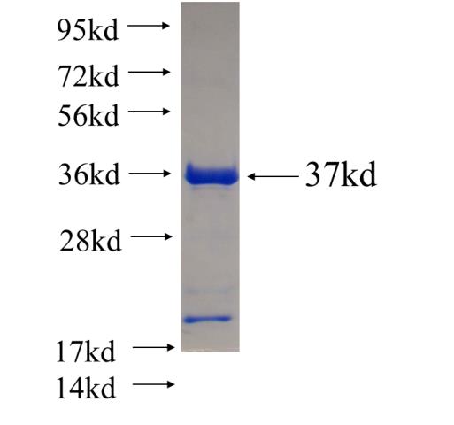 Recombinant human SH3GL2 SDS-PAGE