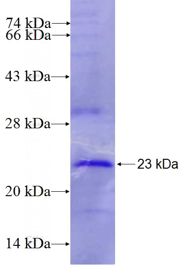 Recombinant Human EDN3 SDS-PAGE