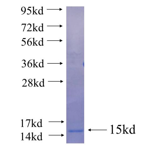 Recombinant human FZD2 SDS-PAGE