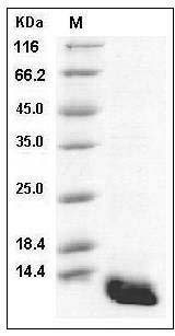 Human S100A8 / CAGA Protein (His Tag) SDS-PAGE