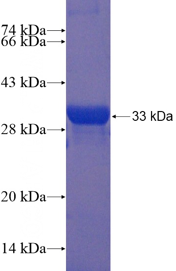 Recombinant Human PSMA6 SDS-PAGE