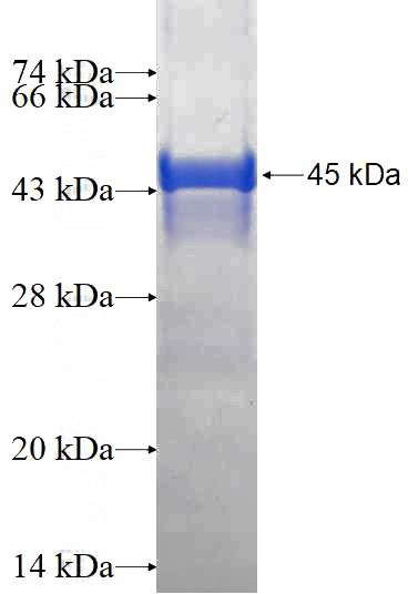 Recombinant Human HAPLN4 SDS-PAGE