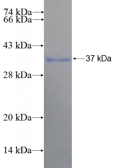Recombinant Human JMJD3 SDS-PAGE