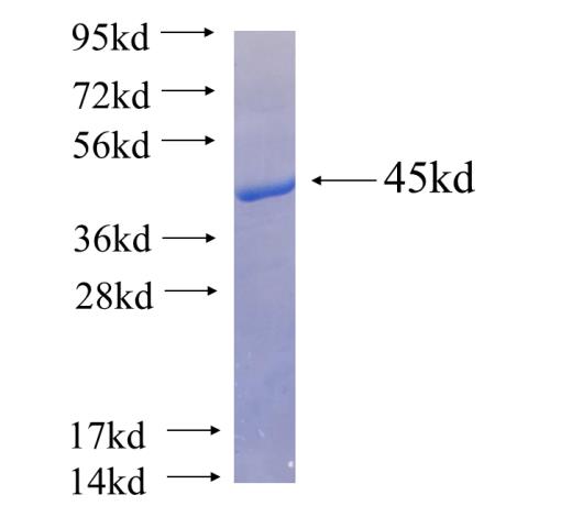 Recombinant human MTHFD1L SDS-PAGE