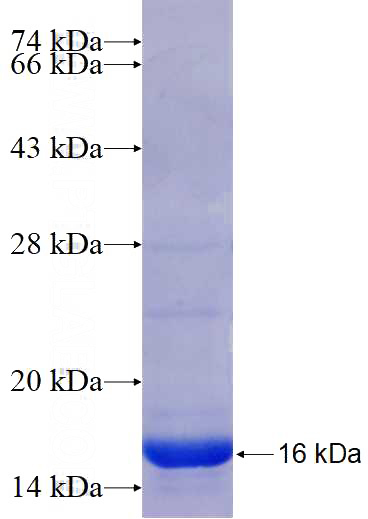 Recombinant Human TAGLN2 SDS-PAGE