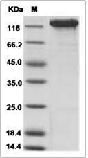 Rat Siglec-2 / CD22 Protein (Fc Tag)