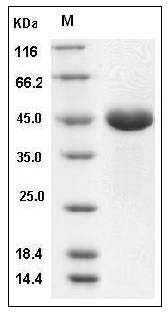 Human PGA4 / Pepsinogen A Protein (His Tag) SDS-PAGE