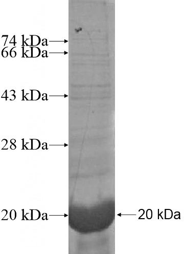 Recombinant Human DRD5 SDS-PAGE