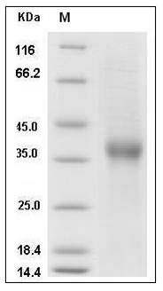 Human CD8B / P37 / LEU2 Protein (Fc Tag) SDS-PAGE