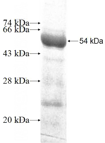 Recombinant Human KLHL14 SDS-PAGE