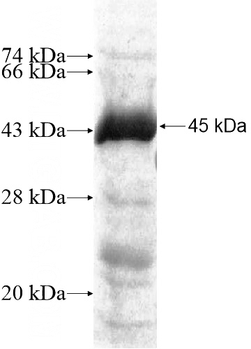 Recombinant Human NGLY1 SDS-PAGE