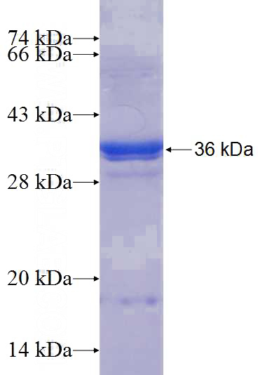 Recombinant Human VPS37D SDS-PAGE