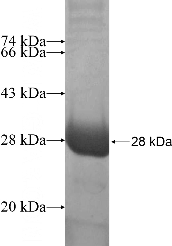 Recombinant Human SSSCA1 SDS-PAGE