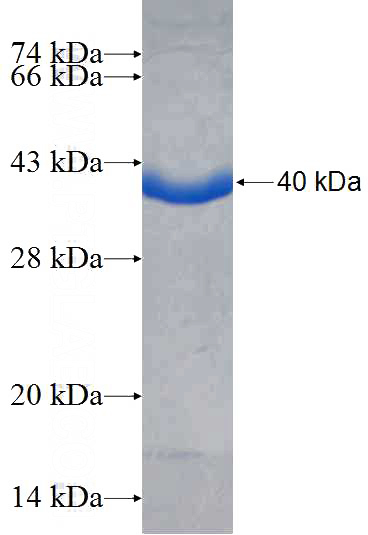 Recombinant Human SMG7 SDS-PAGE