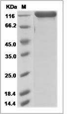 Mouse DPP4 / CD26 Protein (Fc Tag) SDS-PAGE