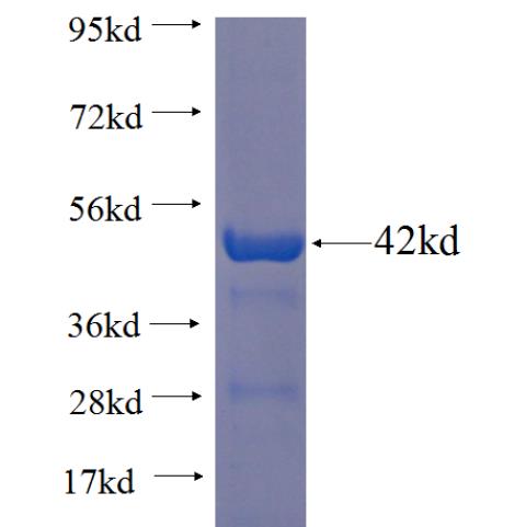 Recombinant human BFAR SDS-PAGE