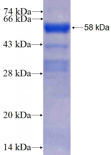 Recombinant Human EFTUD2 SDS-PAGE