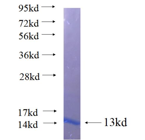 Recombinant human FGD6 SDS-PAGE