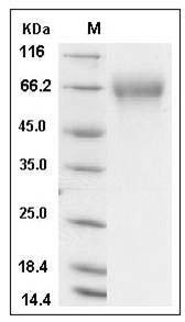 Influenza B (B/Brisbane/60/2008) Hemagglutinin Protein (HA1 Subunit) (His Tag) SDS-PAGE