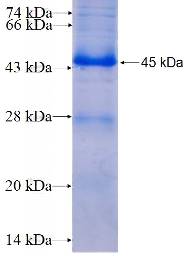 Recombinant Human BBS5 SDS-PAGE