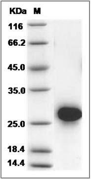 Rat CD40 / TNFRSF5 Protein (His Tag) SDS-PAGE
