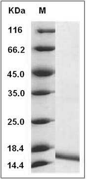 Human IL36G / IL1F9 Protein (aa 18-169) SDS-PAGE