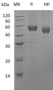 Human CD14 (His tag) recombinant protein