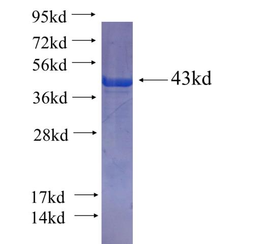 Recombinant human PLB1 SDS-PAGE