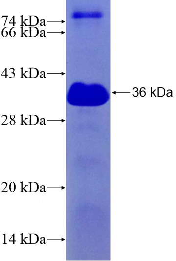 Recombinant Human ARHGAP18 SDS-PAGE