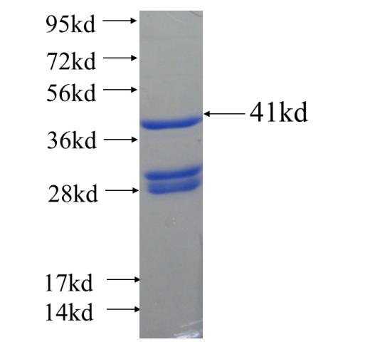 Recombinant human VSX2 SDS-PAGE