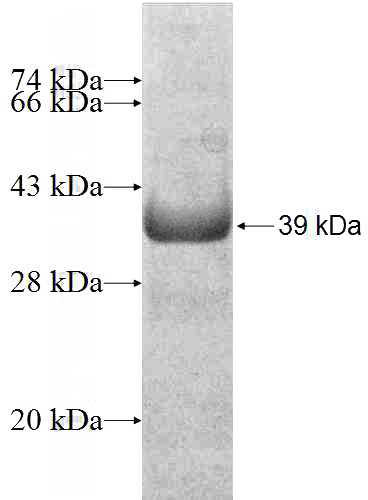 Recombinant Human CAPZA2 SDS-PAGE