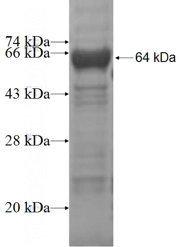 Recombinant Human PSMD11 SDS-PAGE