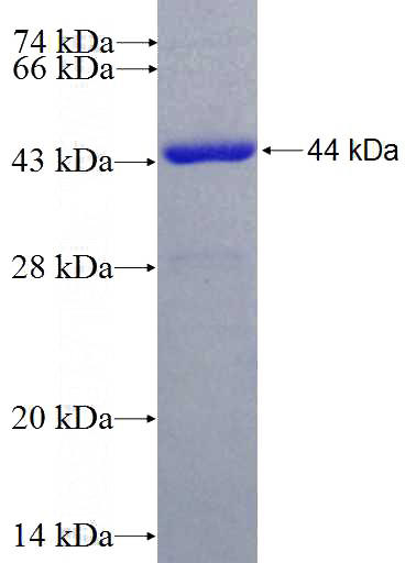 Recombinant Human ALDH2 SDS-PAGE