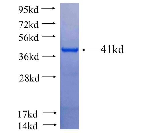 Recombinant human CASR SDS-PAGE