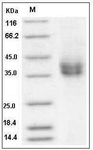 Rat CD89 / FCAR Protein (His Tag) SDS-PAGE