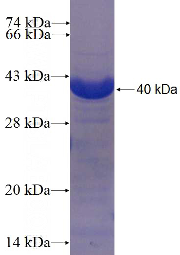 Recombinant Human TP53TG5 SDS-PAGE