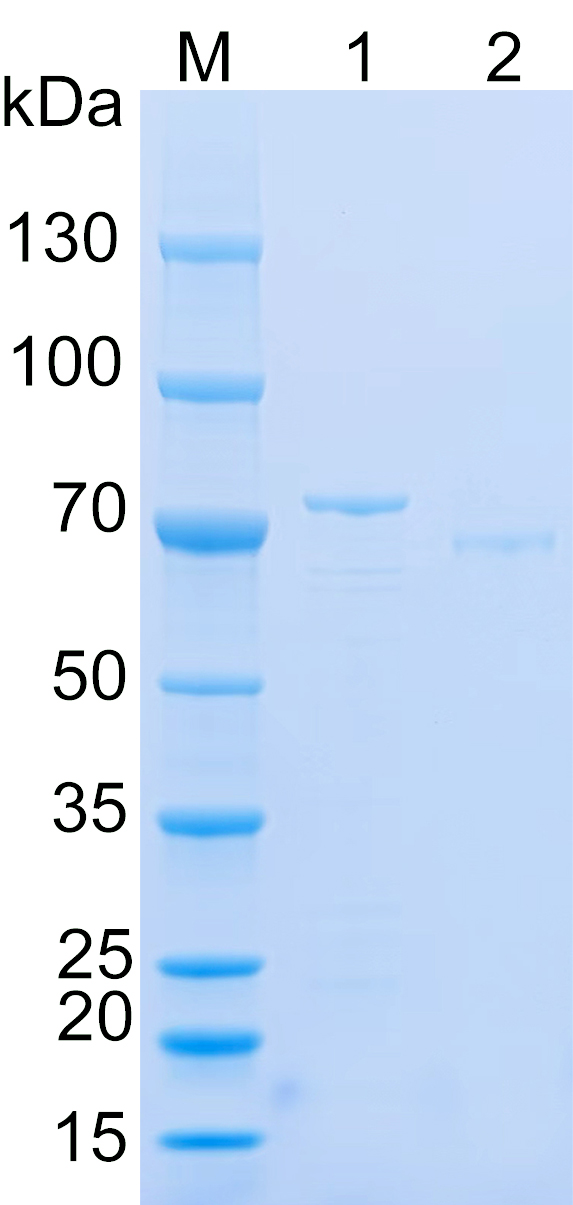Recombinant Human STAG1 SDS-PAGE