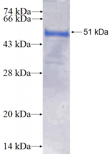 Recombinant Human THAP1 SDS-PAGE