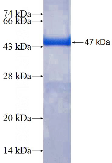 Recombinant Human INPP5K SDS-PAGE