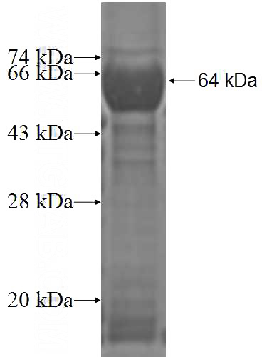 Recombinant Human COPG SDS-PAGE
