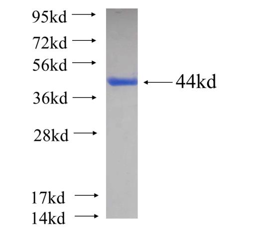 Recombinant human MYO1A SDS-PAGE