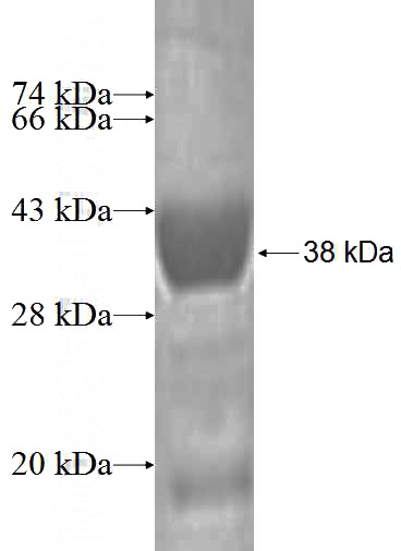 Recombinant Human MYCBP SDS-PAGE