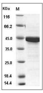 Human PTMA Protein (GST Tag) SDS-PAGE