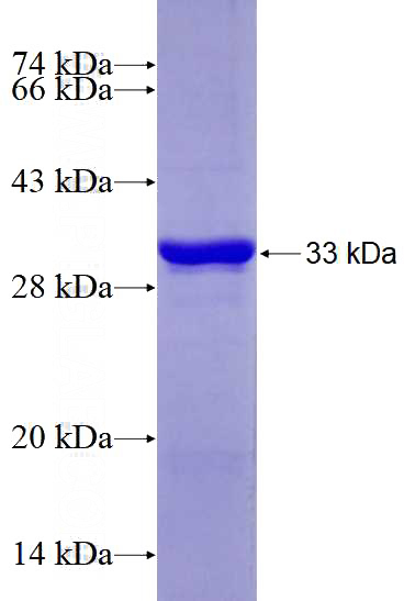 Recombinant Human GK5 SDS-PAGE