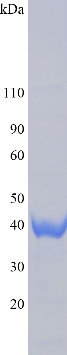 Recombinant human UBR5 SDS-PAGE